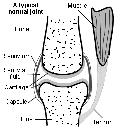 Arthritis understanding joints