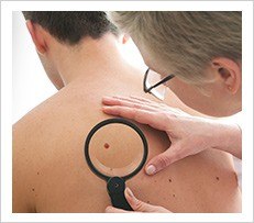 skin checkup 